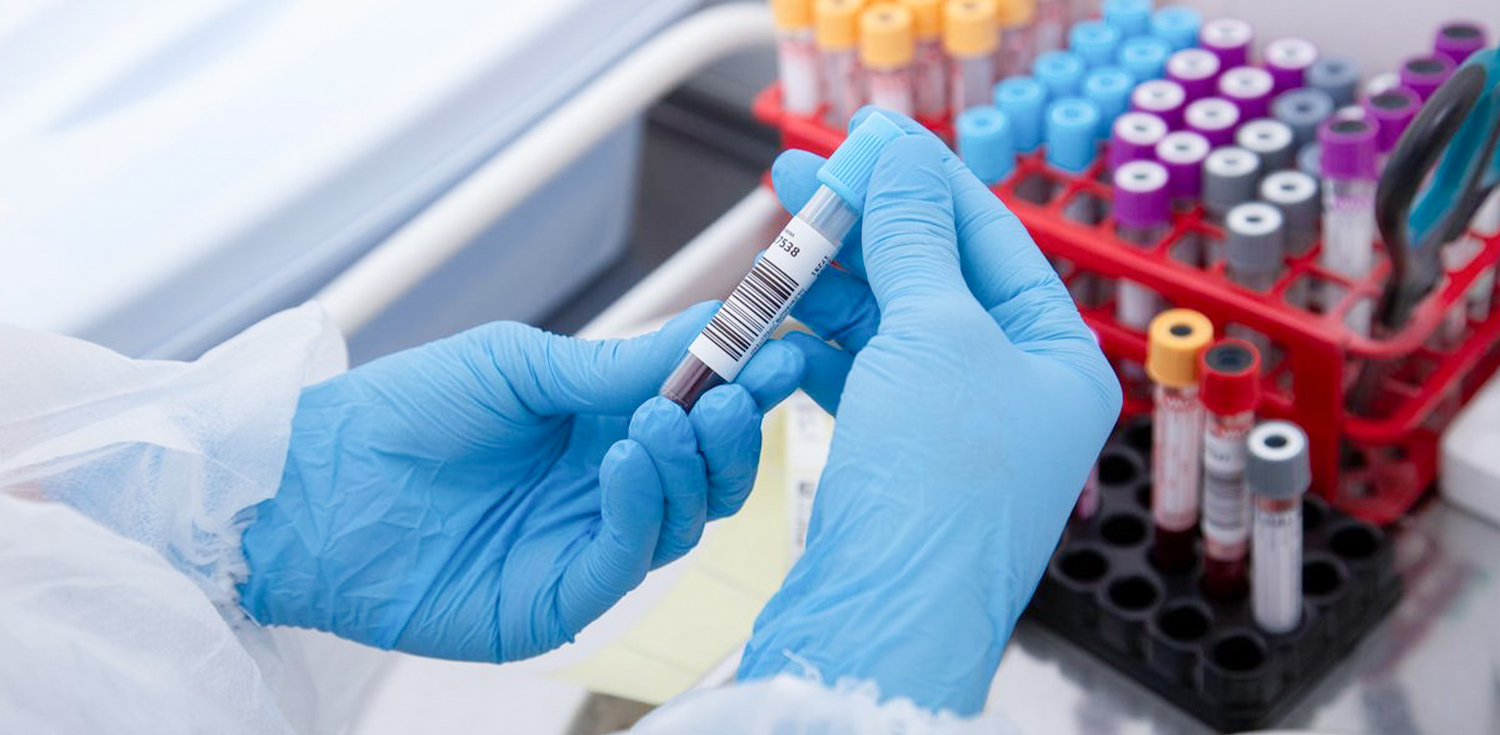 2022-10-21-Blood Coagulation Analyzer-DETAILS